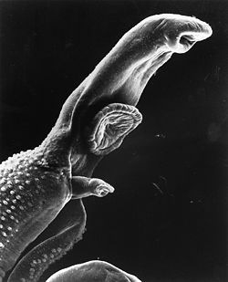 250px-Schistosome_Parasite_SEM.jpg