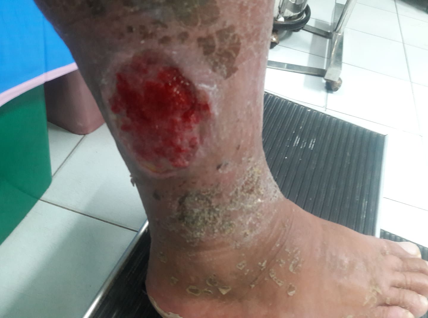 foot (4).jpg