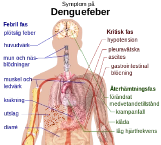 Helse-Dengue_fever_symptoms_sv_svg-749602.webp