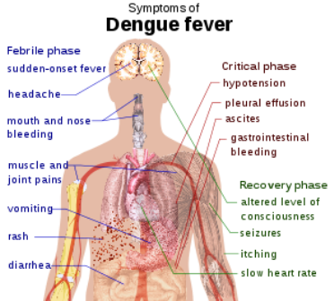 Helse-denguefeber-symptomer-insidecostaricacom-788877.png