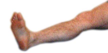 leg.JPG