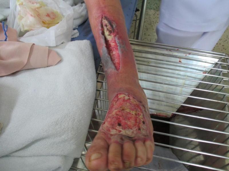 post-6037-0-68580100-1406633804_thumb.jpg