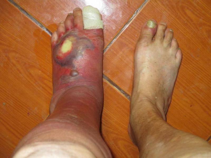 post-6037-0-77271300-1406633774_thumb.jpg